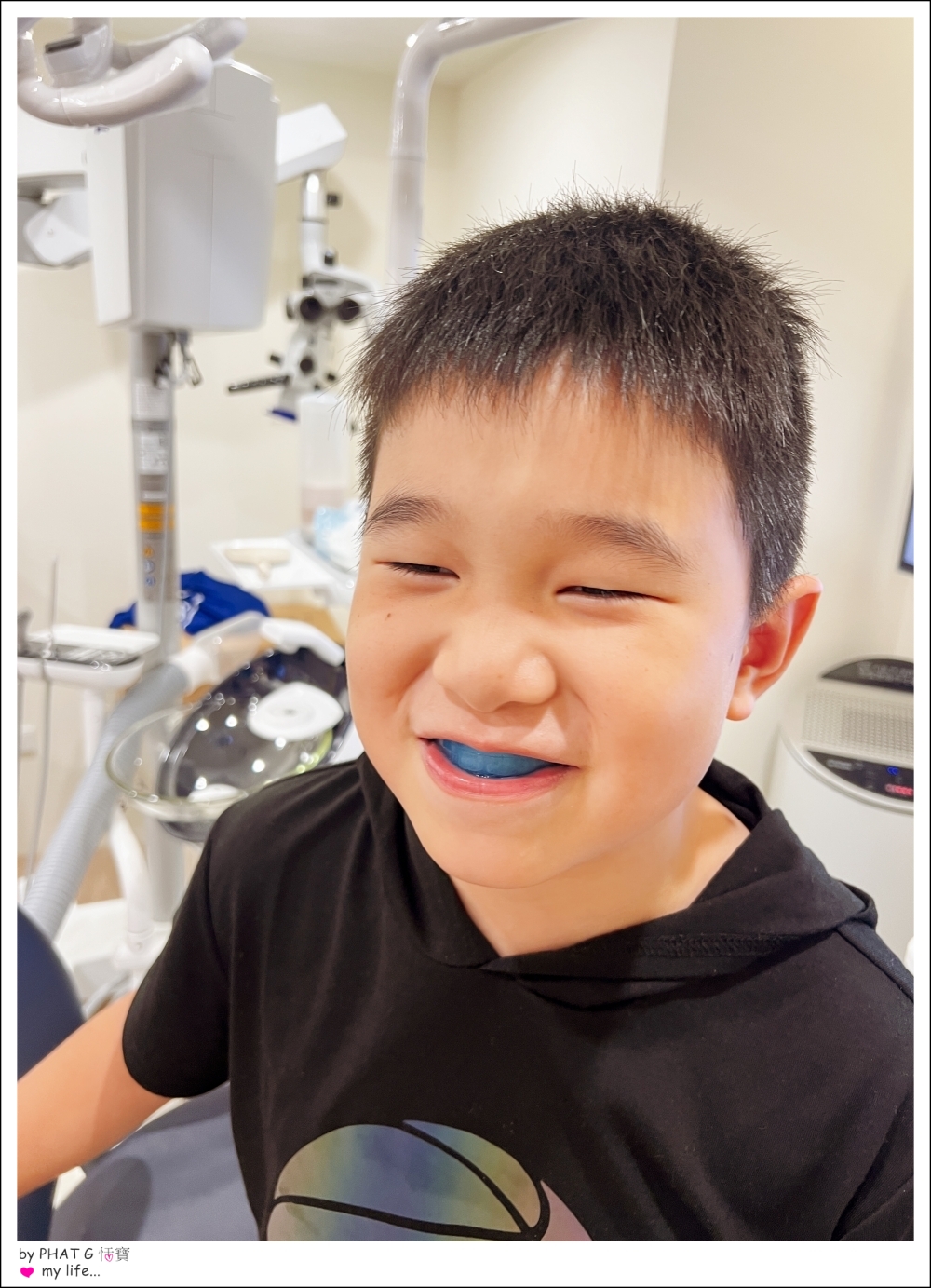 【❤ 兒童牙齒】把握黃金期 6~10歲  兒童MRC功能性矯